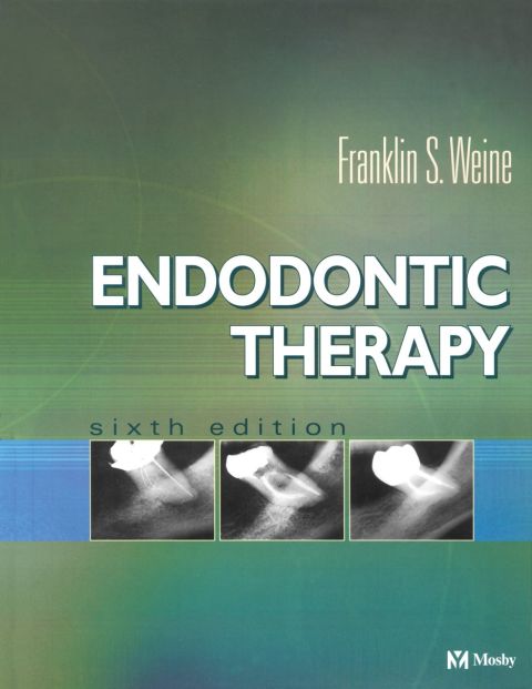 Endodontic Therapy, 6th Edition - FULL INSTANT DOWNLOAD | PDF DOCX EPUB