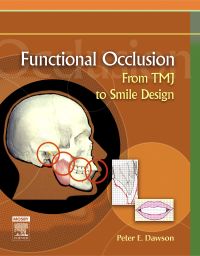 Cover image: Functional Occlusion 1st edition 9780323033718