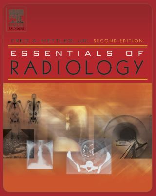 Cover image: Essentials of Radiology 2nd edition 9780721605272