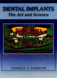 Cover image: Dental Implants: The Art and Science 2nd edition