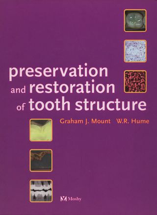 Cover image: Preservation & Restoration of Tooth Structure 1st edition