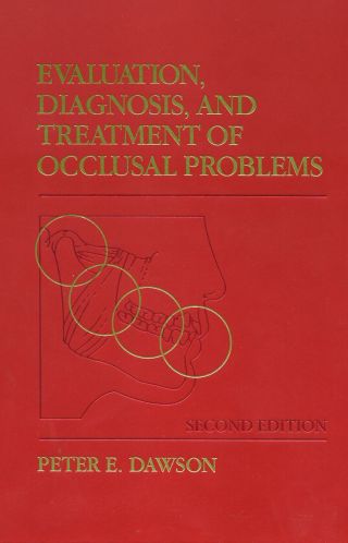 Evaluation, Diagnosis and Treatment of Occlusal Problems 2nd