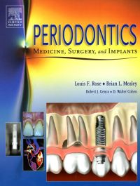 Cover image: Periodontics: Medicine, Surgery and Implants 1st edition 9780801679780