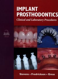 Cover image: Implant Prosthodontics: Clinical and Laboratory Procedures 2nd edition