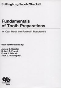Cover image: Fundamentals of Tooth Preparation: For Cast Metal and Porcelain Restorations 1st edition
