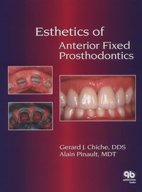 Cover image: Esthetics of Anterior Fixed Prosthodontics: 1st edition