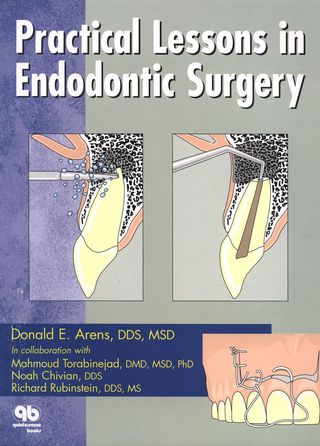 Cover image: Practical Lessons in Endodontic Surgery 1st edition