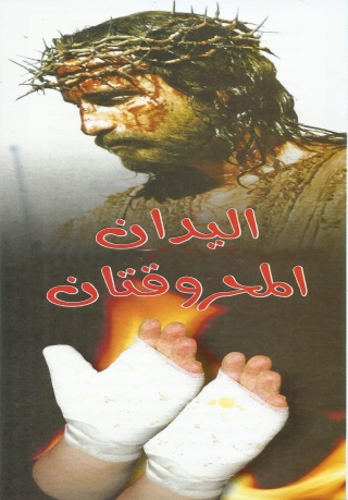 Immagine di copertina: اليدان المحروقتان 1st edition 06681KTAB