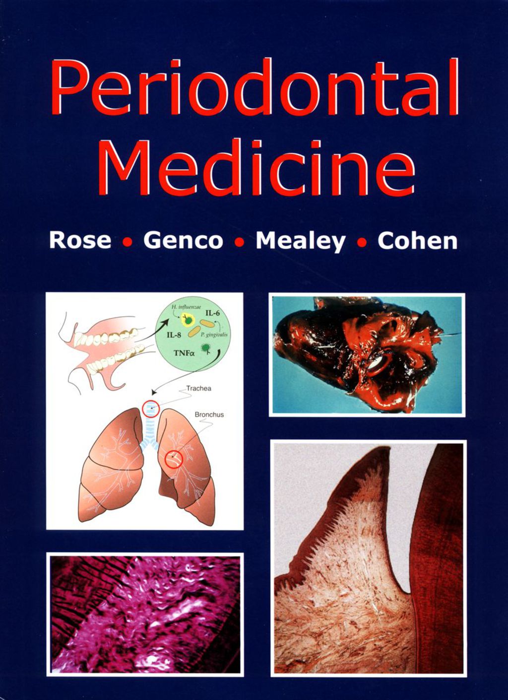 ISBN 9781550091205 product image for Periodontal Medicine - 1st Edition (eBook) | upcitemdb.com