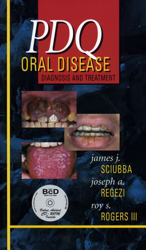 PDQ Oral Disease: Diagnosis and Treatment, 1st Edition - FULL INSTANT DOWNLOAD | PDF DOCX EPUB