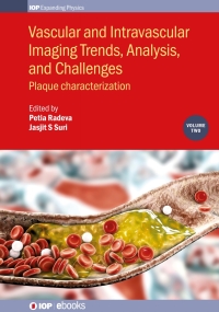 表紙画像: Vascular and Intravaslcular Imaging Trends, Analysis, and Challenges  - Volume 2 1st edition 9780750319997