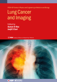 Cover image: Lung Cancer and Imaging 1st edition 9780750325417