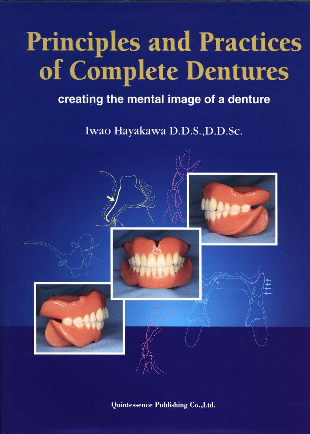 ISBN 9784874176078 product image for Principles and Practice of Complete Dentures: Creating the Mental Image of a Den | upcitemdb.com