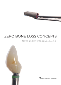 Imagen de portada: Zero Bone Loss Concepts 1st edition 9780867157994