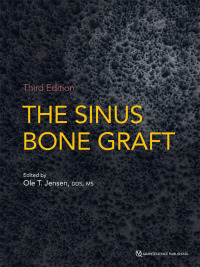 Cover image: The Sinus Bone Graft, Third Edition 3rd edition 9780867157918