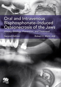 Cover image: Oral and Intravenous Bisphosphonate–Induced Osteonecrosis of the Jaws: History, Etiology, Prevention, and Treatment 2nd edition 9780867155105
