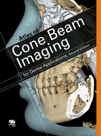 Cover image: Atlas of Cone Beam Imaging for Dental Applications, Second Edition 2nd edition 9780867155655