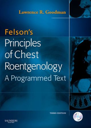 Cover image: Felson's Principles of Chest Roentgenology 3rd edition 9781416029236