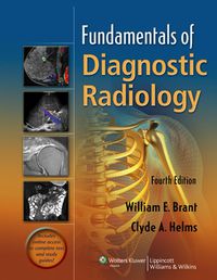 Cover image: Fundamentals of Diagnostic Radiology 4th edition 9781608319114