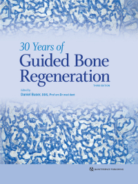 Cover image: 30 Years of Guided Bone Regeneration 3rd edition 9780867158038