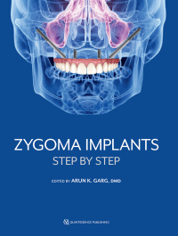Cover image: Zygoma Implants: Step by Step 1st edition 9781647241575
