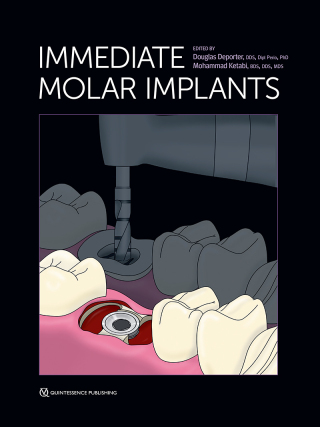 Cover image: Immediate Molar Implants 1st edition 9780867159547