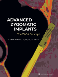 صورة الغلاف: Zygomatic Implants:The Anatomy Guided Approach 1st edition 9781647241698