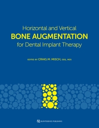 صورة الغلاف: Horizontal and Vertical Bone Augmentation for Dental Implant Therapy 1st edition 9781647241254