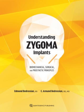 Cover image: Understanding Zygoma Implants: Biomechanical, Surgical, and Prosthetic Principles 1st edition 9781647241957