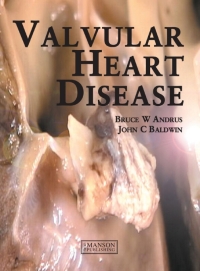 Imagen de portada: Valvular Heart Disease 1st edition 9781840760583
