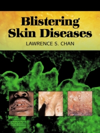 表紙画像: Blistering Skin Diseases 1st edition 9781840761757