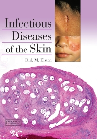 صورة الغلاف: Infectious Diseases of the Skin 1st edition 9781840761771