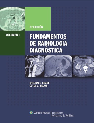 Cover image: Fundamentos de Radiologia Diagnostica 3rd edition 9788496921078
