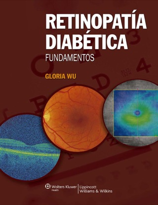 Cover image: Retinopatía diabética. Fundamentos 1st edition 9788496921863
