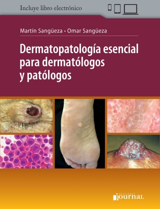 Cover image: Dermatopatología esencial para dermatólogos y patólogos 1st edition 9789874922496
