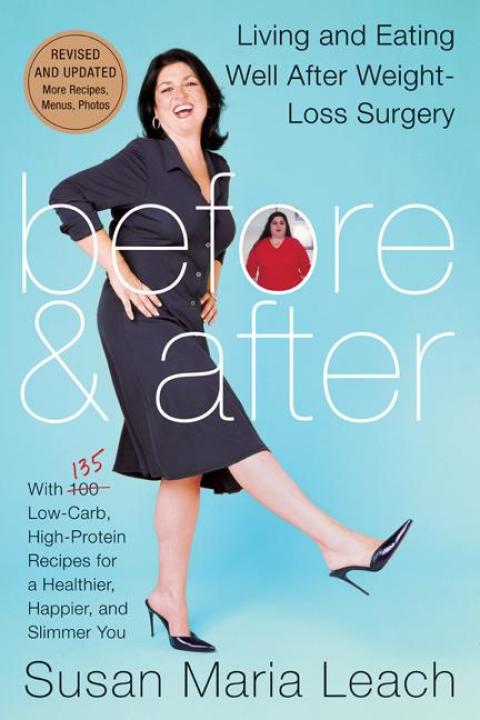 Before & After: Living and Eating Well After Weight-Loss Surgery - FULL INSTANT DOWNLOAD | PDF DOCX EPUB