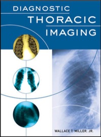 Cover image: Diagnostic Thoracic Imaging 1st edition 9780071413008