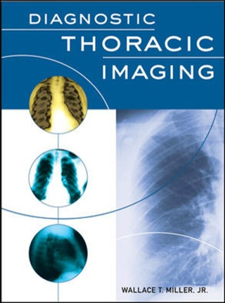 Cover image: Diagnostic Thoracic Imaging 1st edition 9780071413008