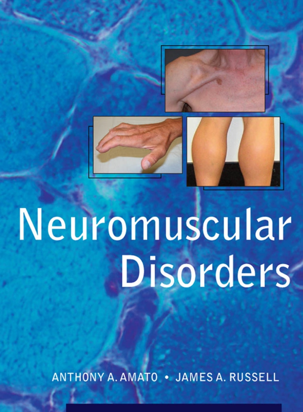 Neuromuscular Disorders 1st Edition