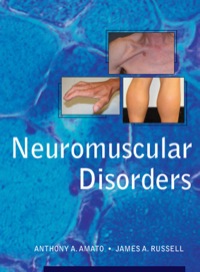 Cover image: Neuromuscular Disorders 1st edition 9780071416122