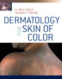Cover image: Dermatology for Skin of Color 1st edition 9780071446716