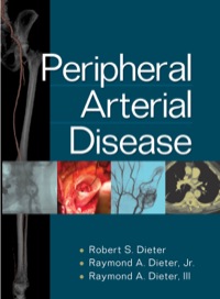 Cover image: Peripheral Arterial Disease 1st edition 9780071481793