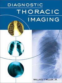 Cover image: Diagnostic Thoracic Imaging 1st edition 9780071413008