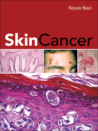 Cover image: Skin Cancer 1st edition 9780071472562