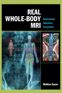 صورة الغلاف: Real Whole-Body MRI: Requirements, Indications, Perspectives 1st edition 9780071498678