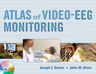 Cover image: Atlas of Video-EEG Monitoring 1st edition 9780071597425