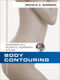 صورة الغلاف: Body Contouring 1st edition 9780071604673