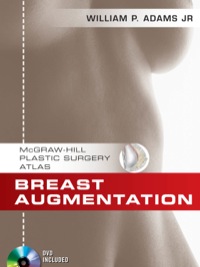Cover image: Breast Augmentation 1st edition 9780071606431