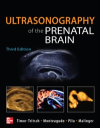 Cover image: Ultrasonography of the Prenatal Brain 3rd edition 9780071613064