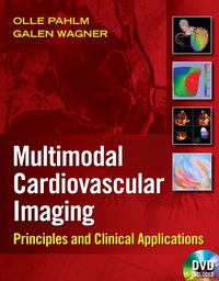 Cover image: Multimodal Cardiovascular Imaging 1st edition 9780071613460